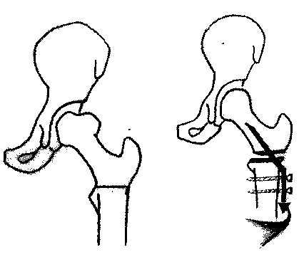 4_1.gif (4277 bytes)