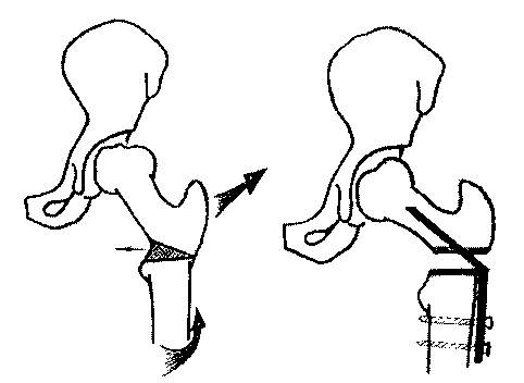 4_2.gif (4425 bytes)