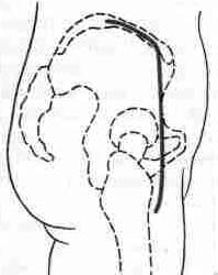 D_S_P.jpg (13603 bytes)