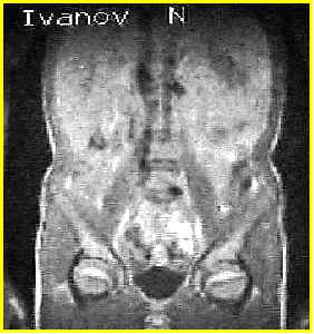 wpe4.jpg (15521 bytes)