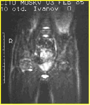 wpe5.jpg (12319 bytes)