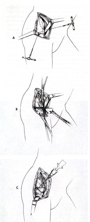 solter.jpg (29418 bytes)