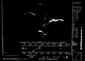 Uzi2s.bmp (6448 bytes)
