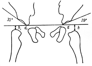 Ris2.bmp (65580 bytes)