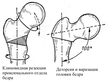 DVOL.BMP (94008 bytes)