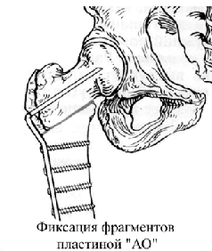 DVOR.BMP (68760 bytes)
