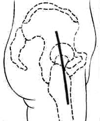 D_B.jpg (13558 bytes)