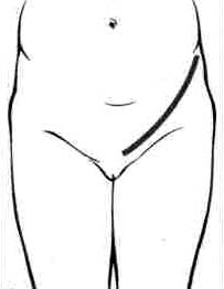 D_Ch.jpg (8281 bytes)