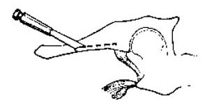 Kening2.jpg (12163 bytes)