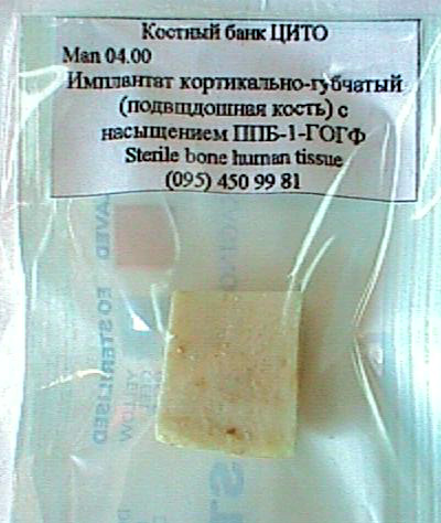 kost_bank.jpg (72300 bytes)