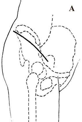 otkr_vprA.jpg (19495 bytes)