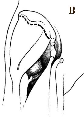 otkr_vprB.jpg (21894 bytes)
